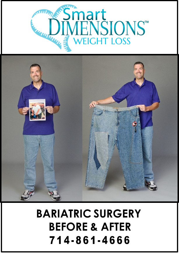 Bariatric Surgery Before After Los Angeles Fountain Valley CA